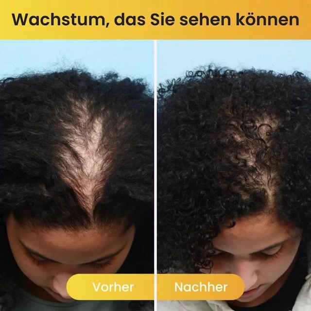 WellaNaturals image